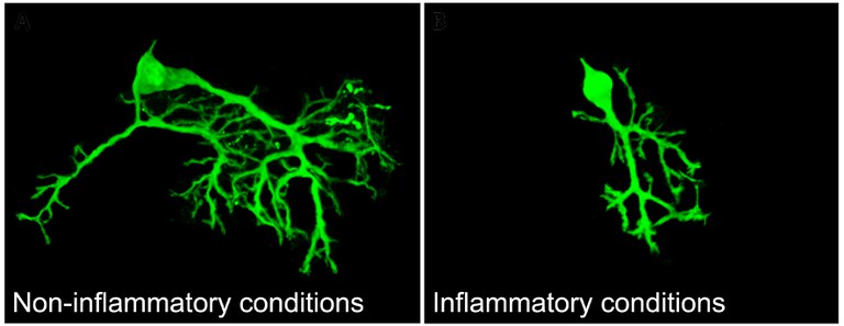 Homepage_inflammation