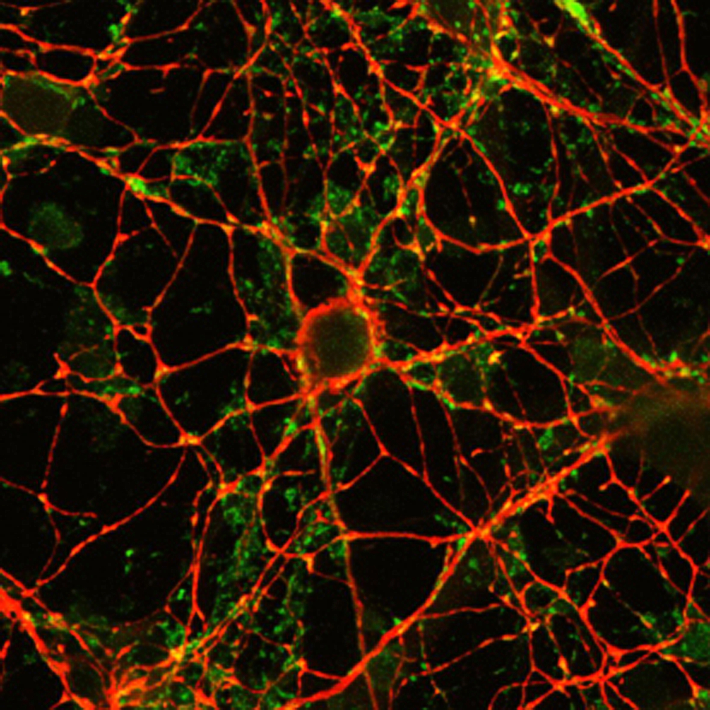 Homepage_interneuron