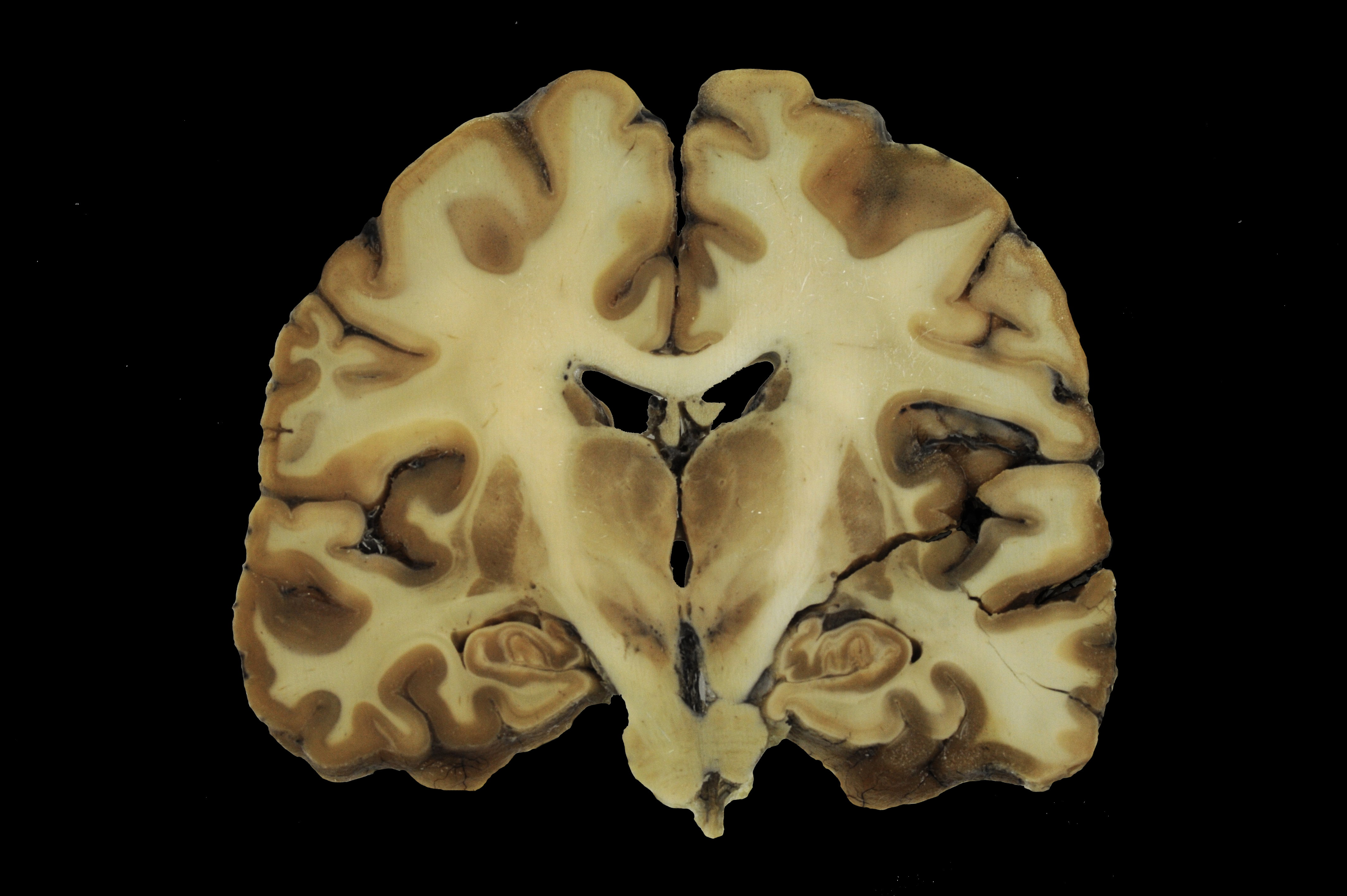 Neuroanatomie_4