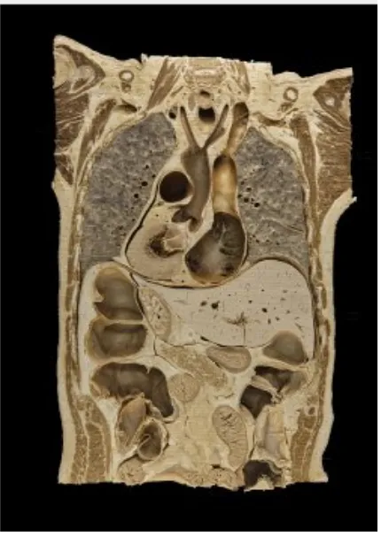 frontalschnitt_01dorsal_anatomisches_institut_der_universitaet_bonn_3.webp