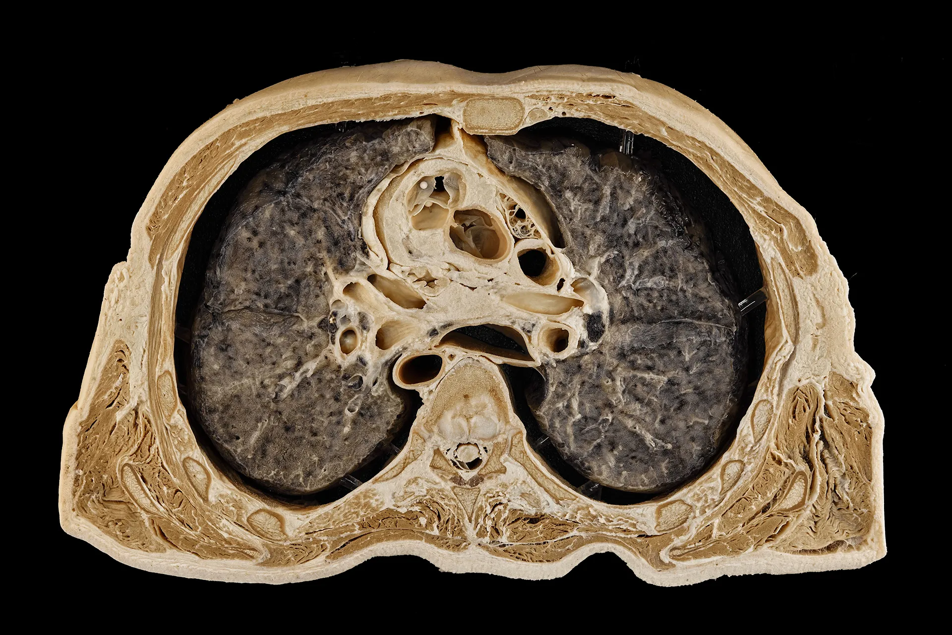 schnittpraeparat_anatomisches_institut_der_universitaet_bonn_1.webp